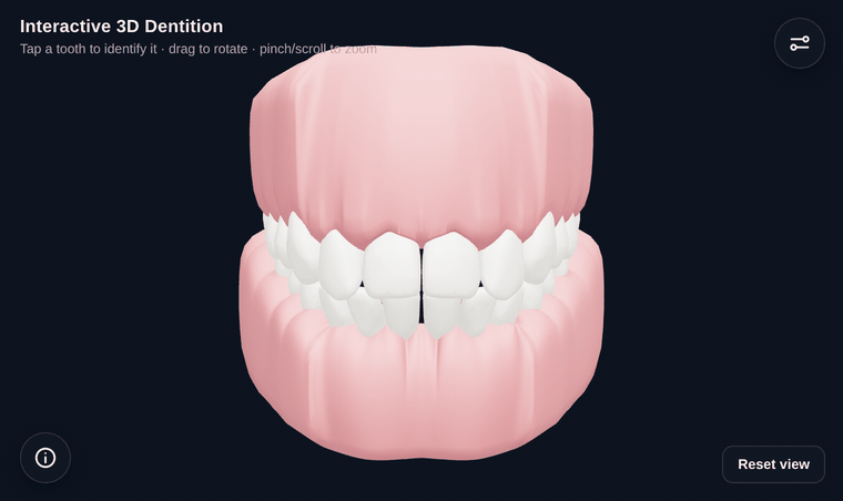 Carlow Dental Implant 3D 뷰어 미리보기